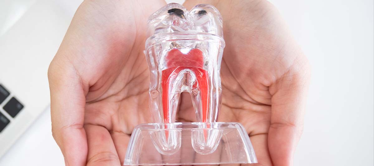 根管治療の必要性