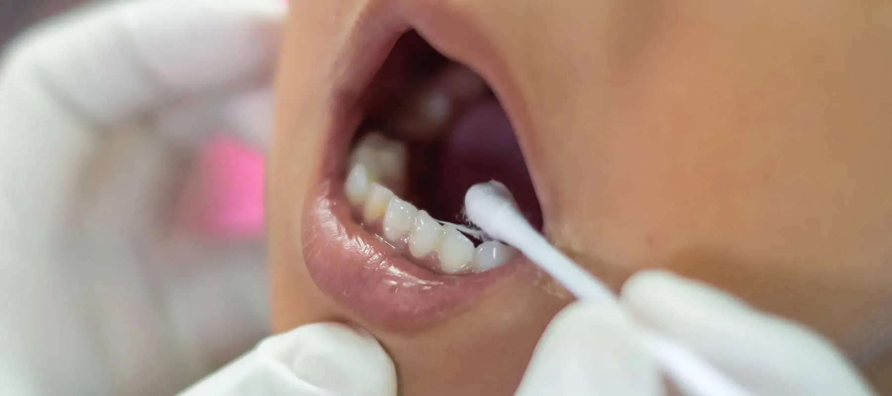 いしはた歯科のインプラント治療の特徴