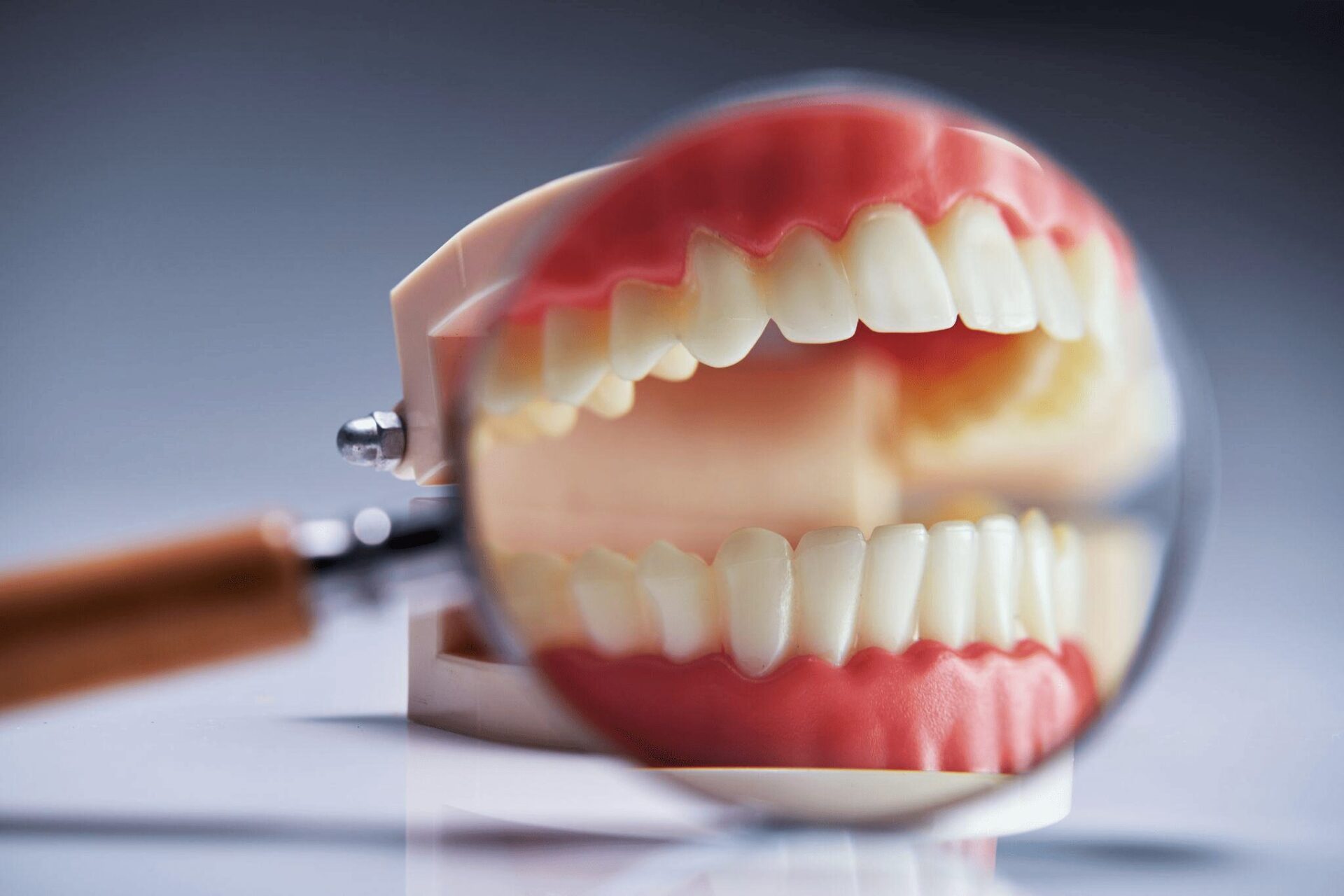 一般歯科で行う治療