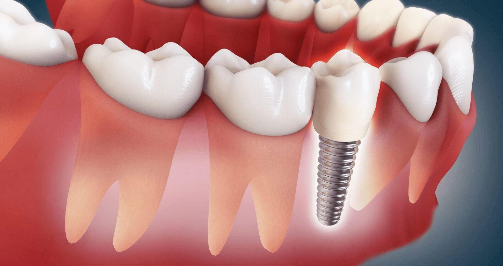 口腔外科で行う治療